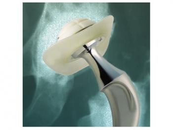 Ogee cup: image from Depuy